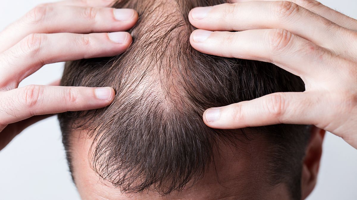 ARTAS aporta a la recuperación capilar un nivel de exactitud única.