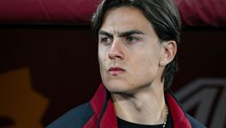 Dybala estará no menos de 45 días sin jugar.