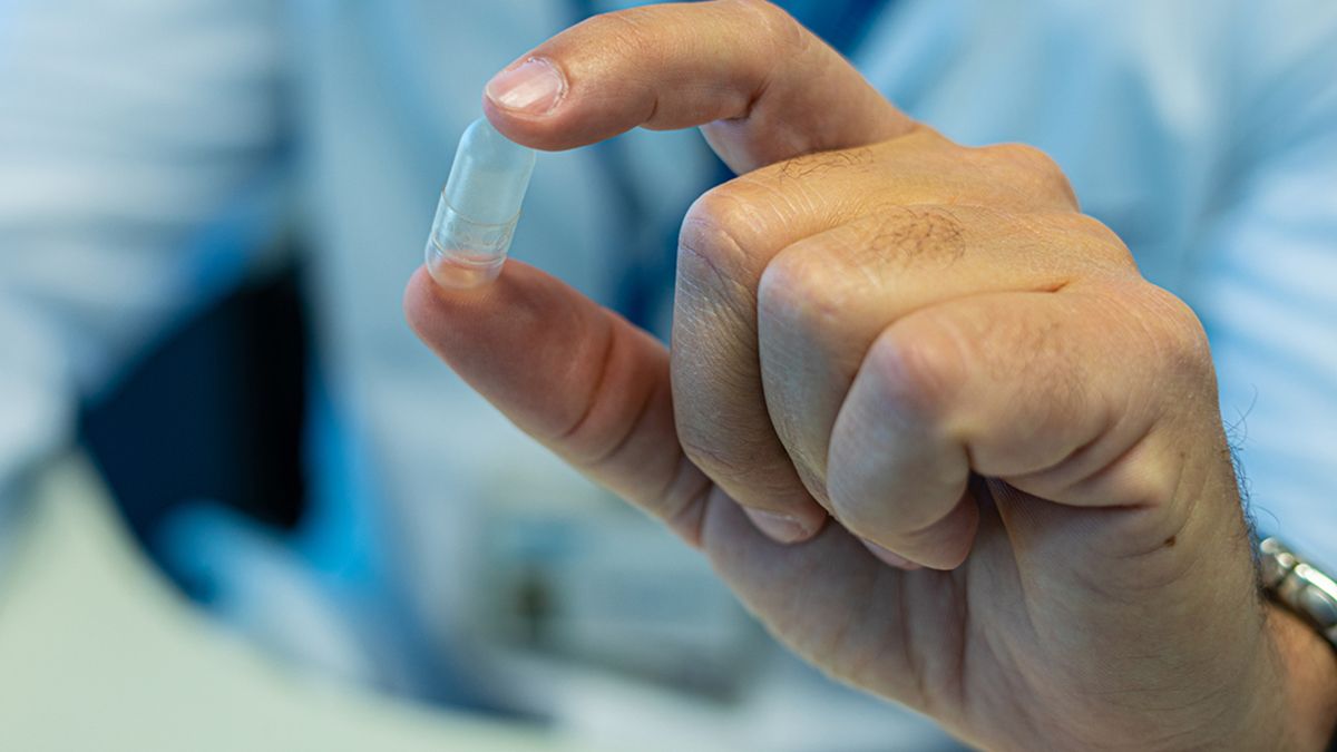 La colocación de la cápsula que luego se transforma en el balón no requiere ningún procedimiento invasivo, así como su extracción.