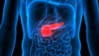 Cáncer de páncreas: la combinación de 2 fármacos que 