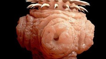 Una mujer sobrevive dos años con un parásito en el cerebro