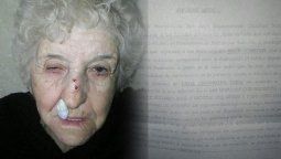 La mujer tiene 80