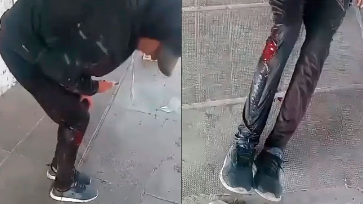 El joven de 16 años recibió un disparo en la pierna luego de que le robaran el celular.