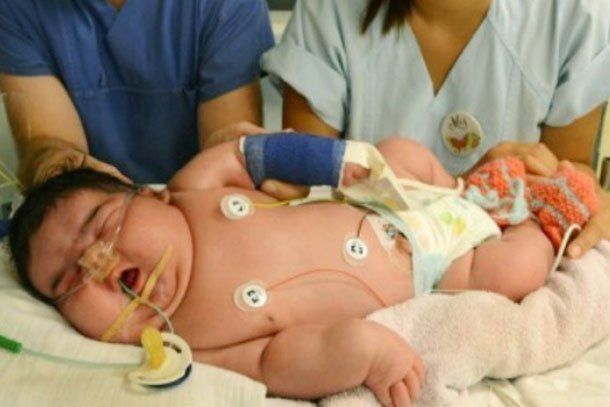 Nació en Alemania el bebé más grande del mundo
