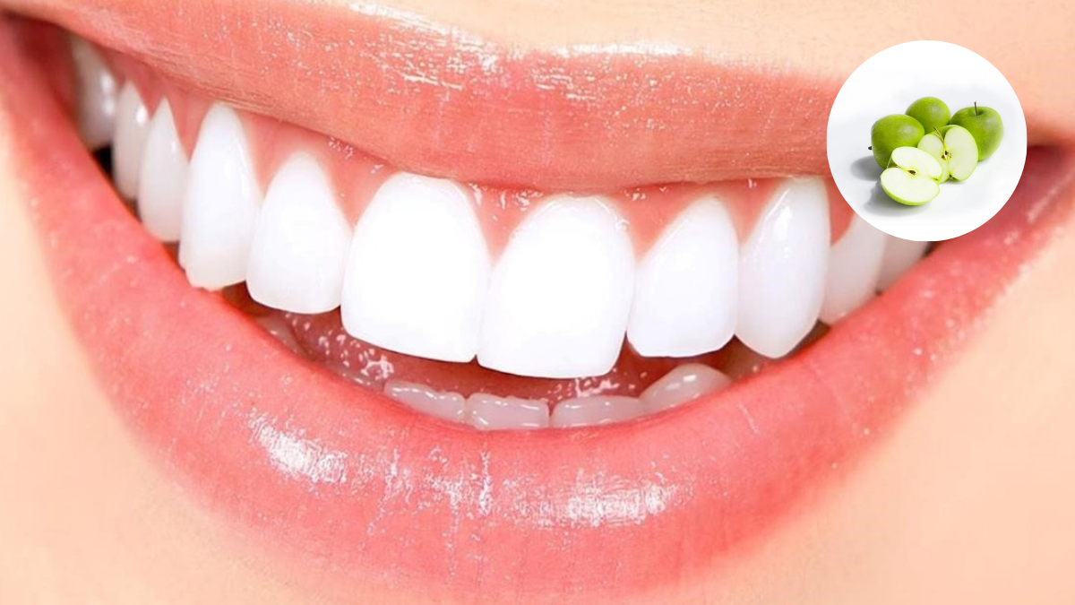 La manzana es un superalimento para blanquear tus dientes. La manzana es un superalimento para blanquear tus dientes.