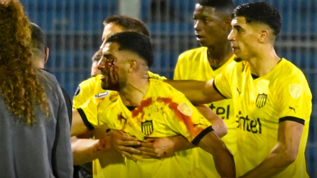 Maximiliano Olivera reaccionó inmediatamente al sufrir la agresión y quiso ir a buscar al agresor. Luego en el camarín sufriría un desmayo debió ser trasladado a una clínica para estudios. Maximiliano Olivera reaccionó inmediatamente al sufrir la agresión y quiso ir a buscar al agresor. Luego en el camarín sufriría un desmayo debió ser trasladado a una clínica para estudios.