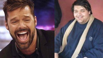 Un argentino se operó 28 veces para parecerse a Ricky Martín