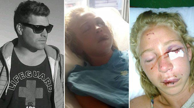 Una joven denunció una brutal paliza de su ex: Me golpeó hasta dejarme inconsciente