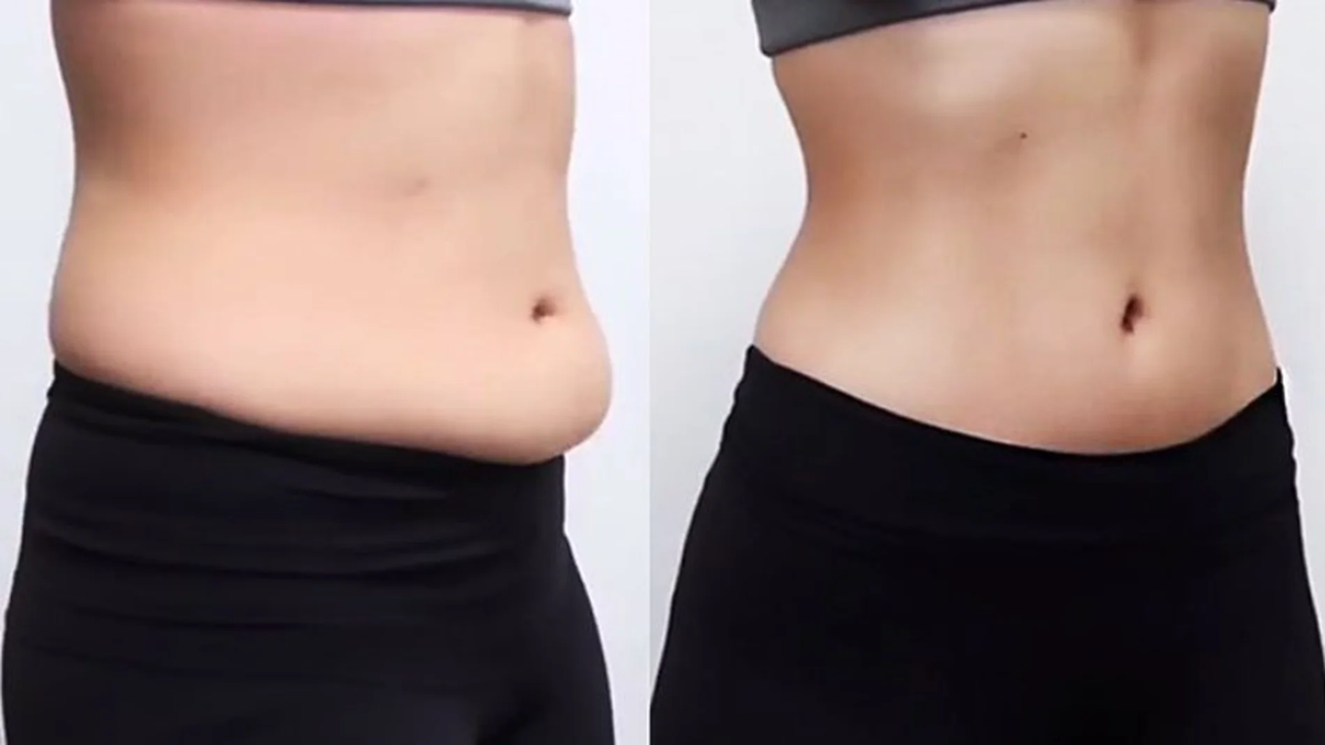 Con este ejercicio verás cómo se te achica el abdomen. Con este ejercicio verás cómo se te achica el abdomen.