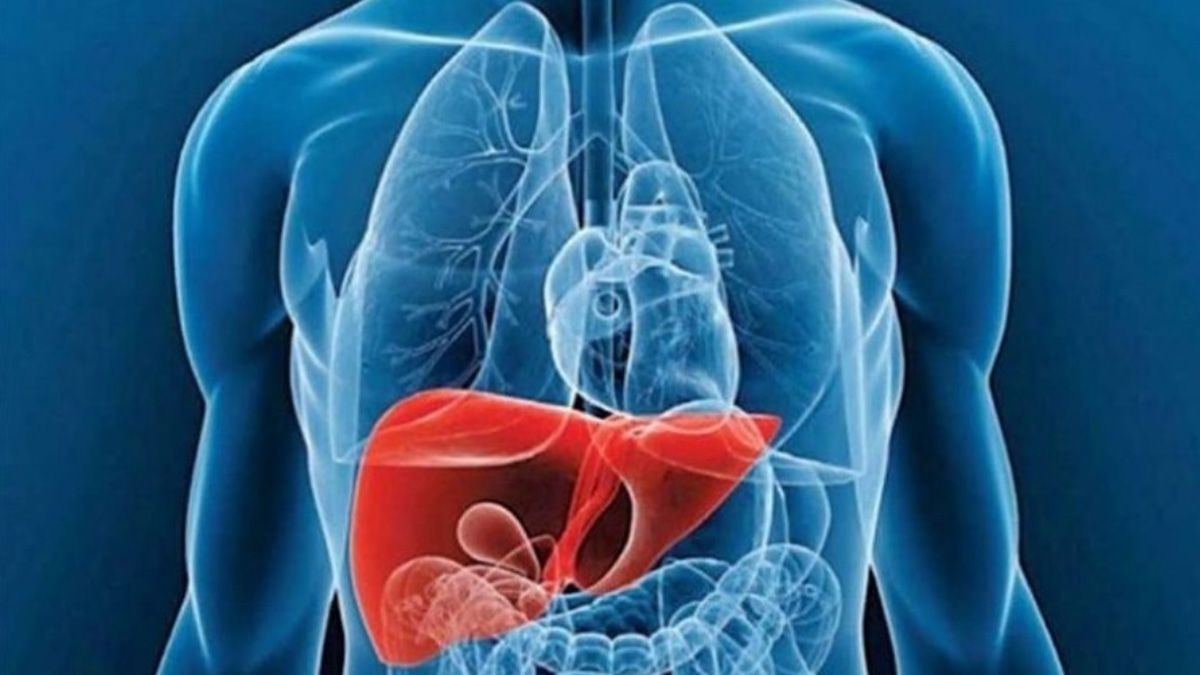 Enfermedad de Gaucher: acceder al diagnóstico y tratamiento tempranos mejora la calidad de vida