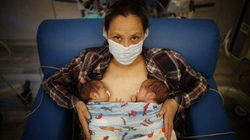 Coronavirus: estuvo 11 días en terapia intensiva, fue mamá de gemelas y no recuerda haber estado embarazada