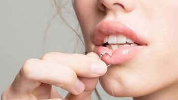 No podían sacárselo: se hizo un piercing en el labio y el desenlace fue trágico No podían sacárselo: se hizo un piercing en el labio y el desenlace fue trágico