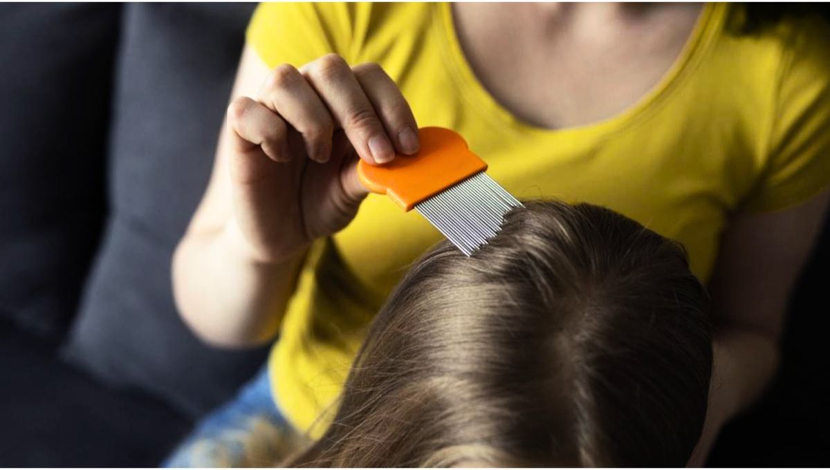 Los piojos pueden ser eliminados a través de una planta medicinal