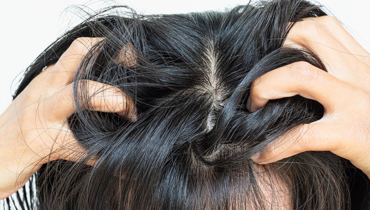 Consulta a tu médico o un especialista antes de realizar cualquier tipo de truco casero en el pelo. Consulta a tu médico o un especialista antes de realizar cualquier tipo de truco casero en el pelo. 