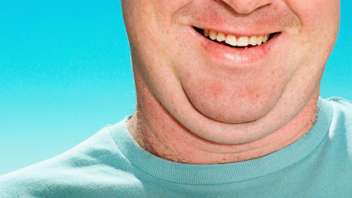 Hay una manera saludable de eliminar la papada. Hay una manera saludable de eliminar la papada.