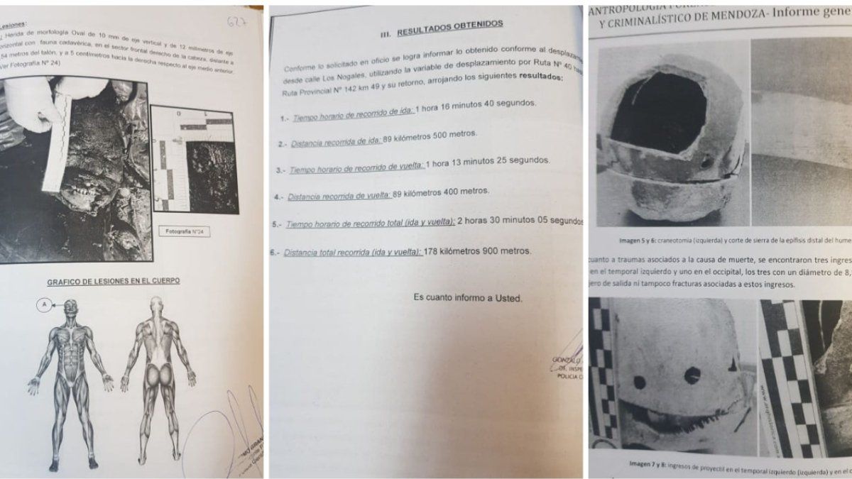 Los impactos de bala en el cráneo.