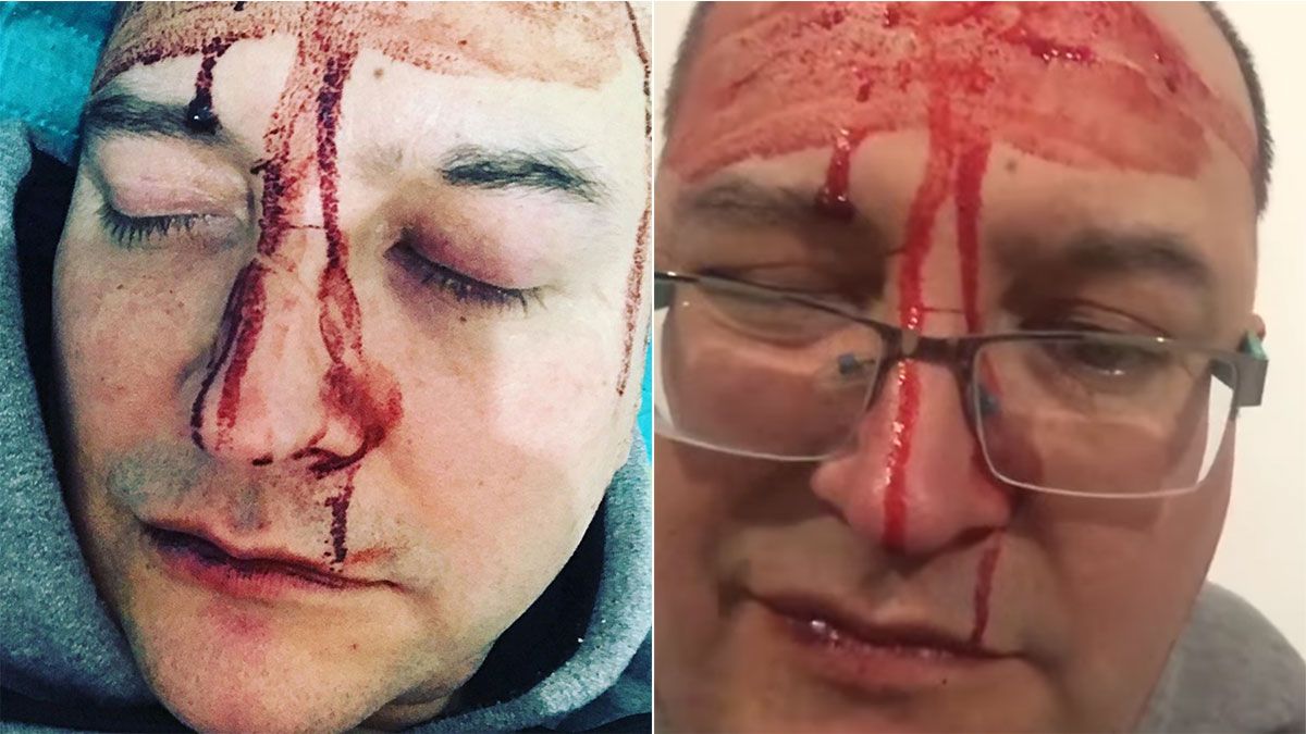 Leo García denunció que le pegaron por ser homosexual