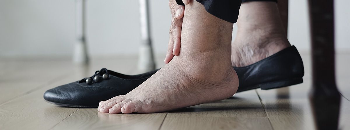 Los tobillos son una parte del cuerpo olvidada por muchas personas. Los tobillos son una parte del cuerpo olvidada por muchas personas. 