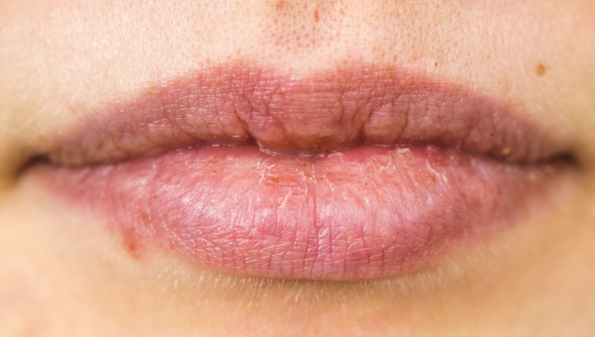 Labios secos. Labios secos. 