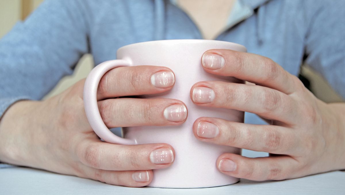 Uñas con rayas. Uñas con rayas.