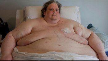 Murió el hombre más gordo del mundo