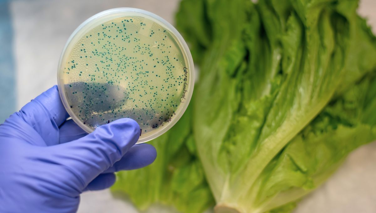 Las enfermedades causadas por alimentos afectan directamente el sistema digestivo. Las enfermedades causadas por alimentos afectan directamente el sistema digestivo.