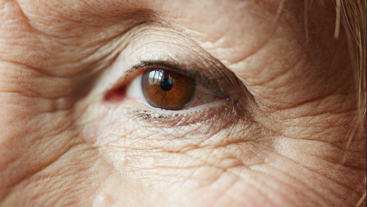 Las personas que recuperaron la visión tienen más de 60 años. Las personas que recuperaron la visión tienen más de 60 años. 