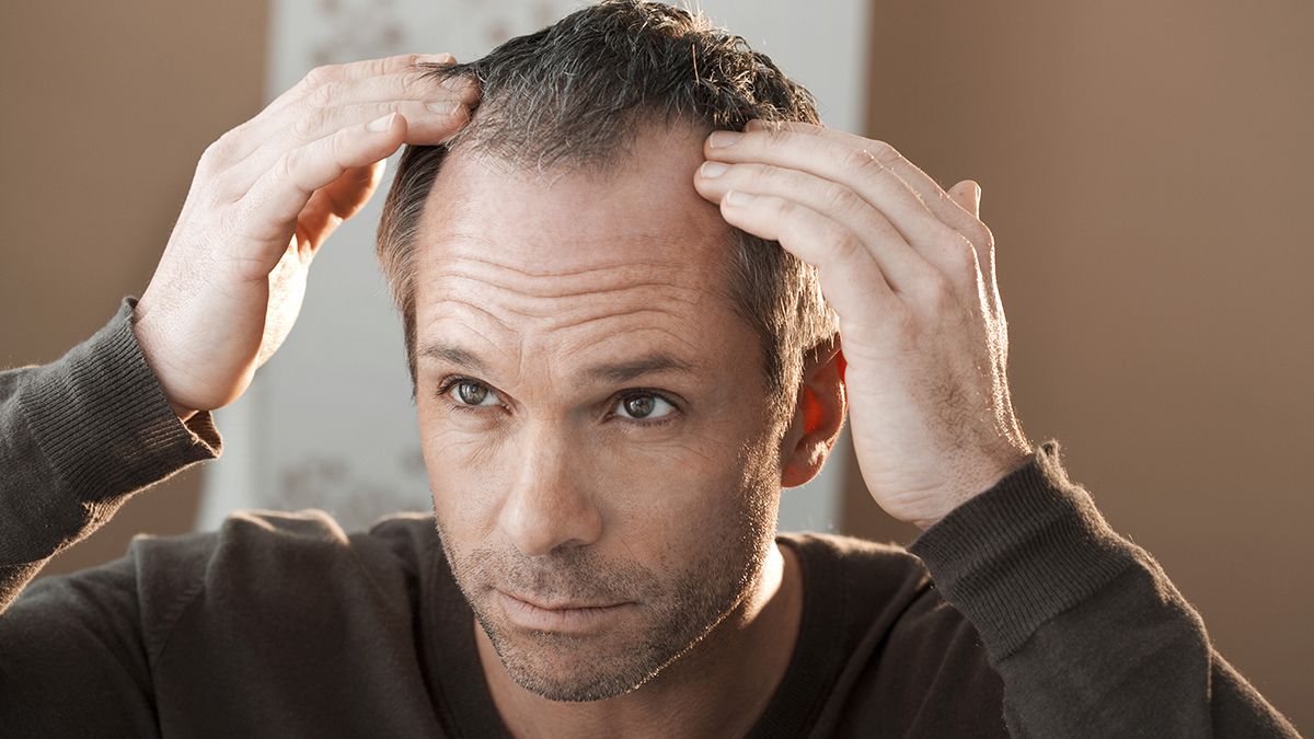 Los remedios caseros para frenar la caída del cabello sólo retrasan la solución