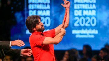 El hombre que simuló cortarse las venas en los Estrellas de mar reveló el motivo por el que lo hizo
