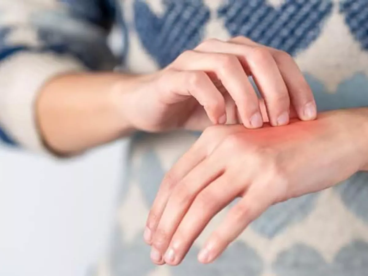 Qué significa que te de comezón en las manos y cómo atraer dinero según el Feng Shui. Qué significa que te de comezón en las manos y cómo atraer dinero según el Feng Shui.