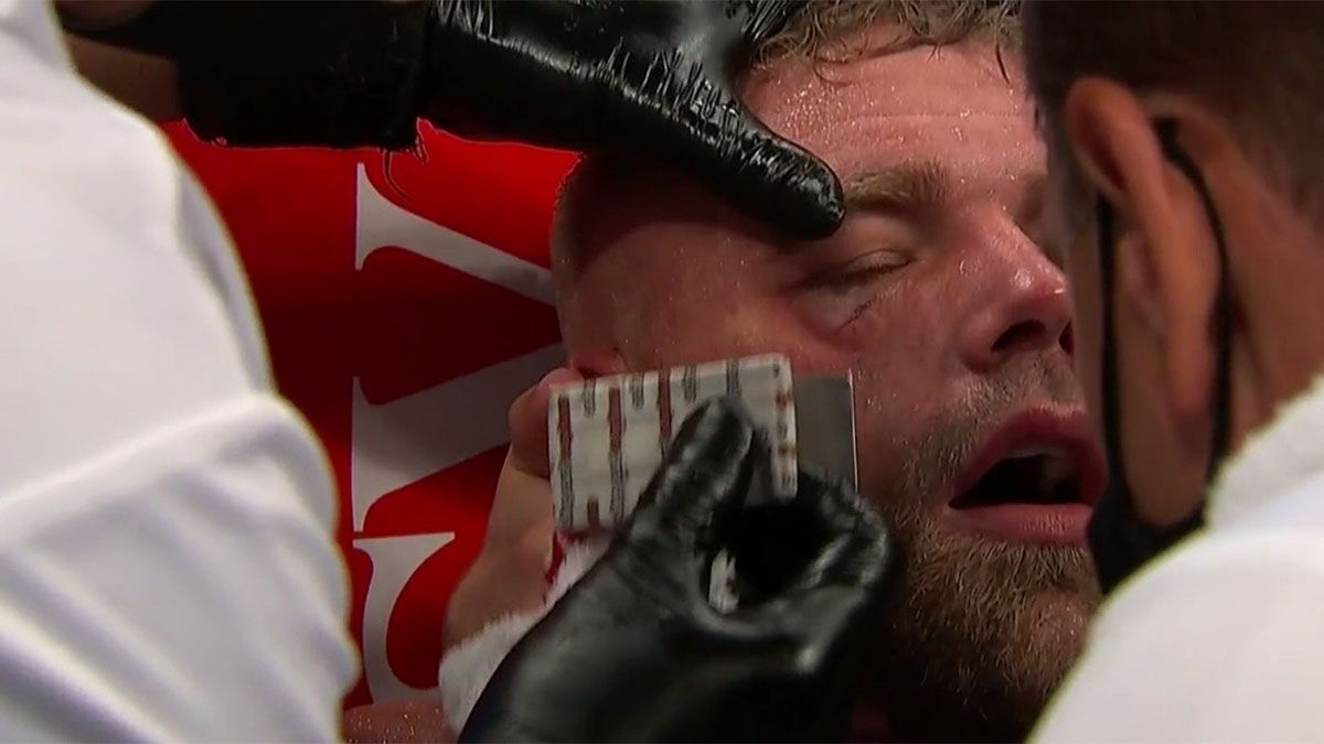 Canelo Álvarez le rompió el pómulo a Billy Joe Saunders