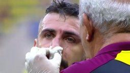 Se fracturó Pratto y fue operado