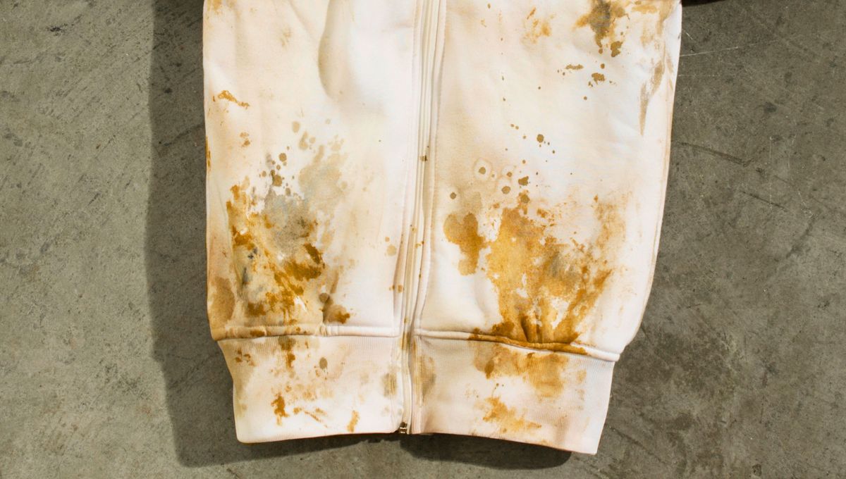 Las manchas en la ropa blanca se notan mucho más y cuesta un montón eliminarlas. Las manchas en la ropa blanca se notan mucho más y cuesta un montón eliminarlas.