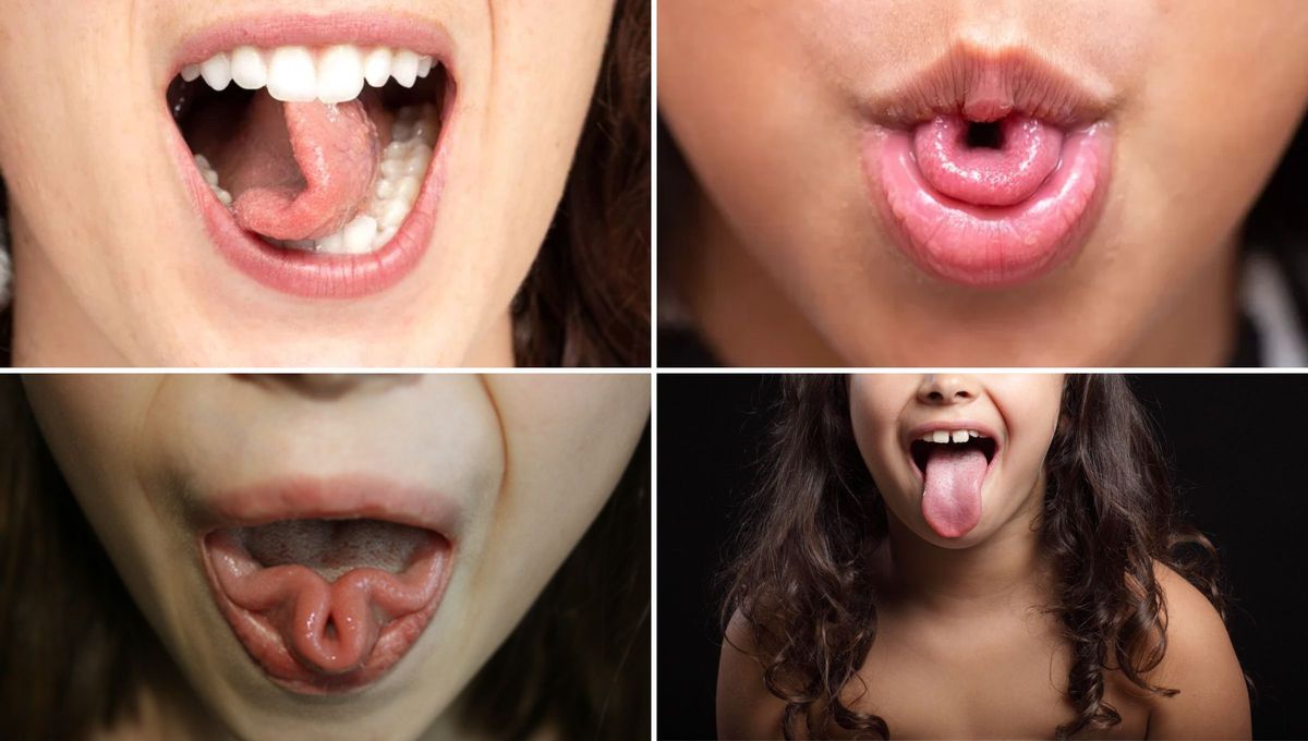 Doblar la lengua de distintas formas puede deberse a un rasgo genético. Aunque, en muchos casos esta acción puede ser consecuencia de práctica o estímulos tempranos Doblar la lengua de distintas formas puede deberse a un rasgo genético. Aunque, en muchos casos esta acción puede ser consecuencia de práctica o estímulos tempranos