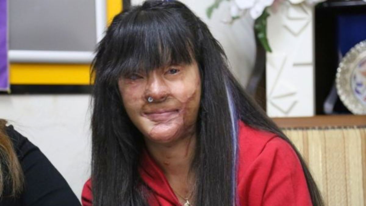 La joven que fue víctima de violencia de género.