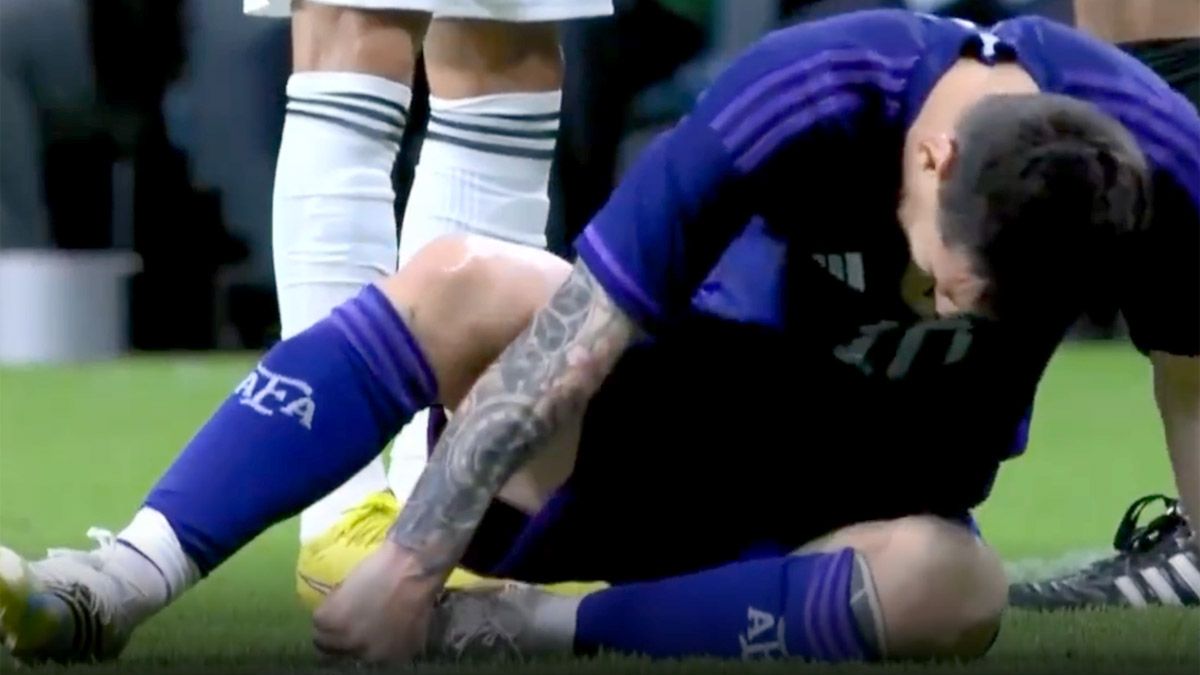 Lionel Messi sufrió un fuerte golpe en Argentina, por parte de un jugador de Emiratos Árabes, en la antesala del Mundial Qatar 2022.