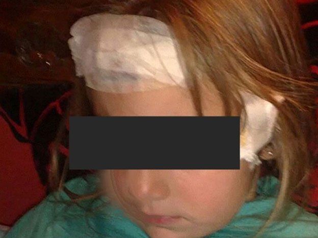 Una niña fue mordida en el rostro por dos perros de una casa vecina