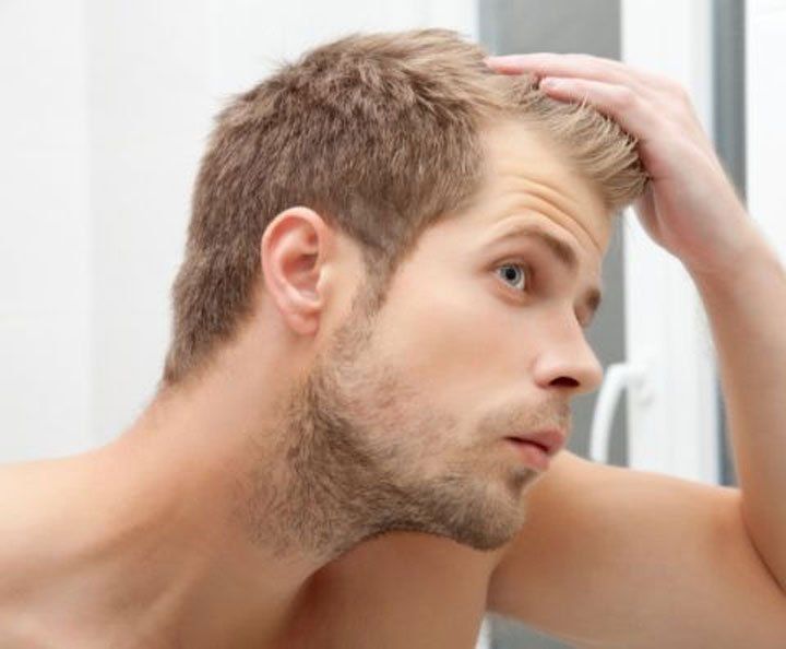 ¿Por qué se nos cae el pelo y cuándo debemos consultar?