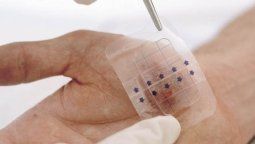 La bioimpresora que trata las heridas de los diabéticos