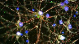 Apuntan a un factor biológico en la esquizofrenia