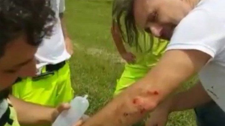 Marcos Di Palma tuvo un accidente impensado