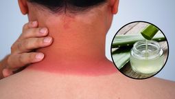 Para aliviar las quemaduras del verano solo se necesita un poco de aloe vera.