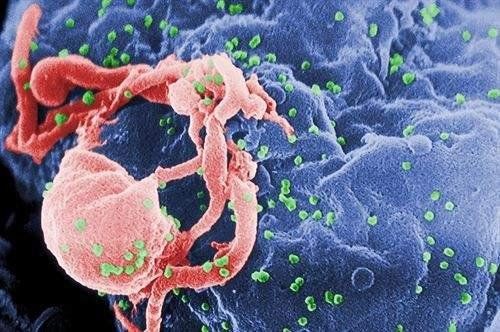 La pandemia de coronavirus podría provocar entre 123 mil y 293 mil nuevas infecciones por VIH y más muertes relacionadas con el sida, señaló Onusida.