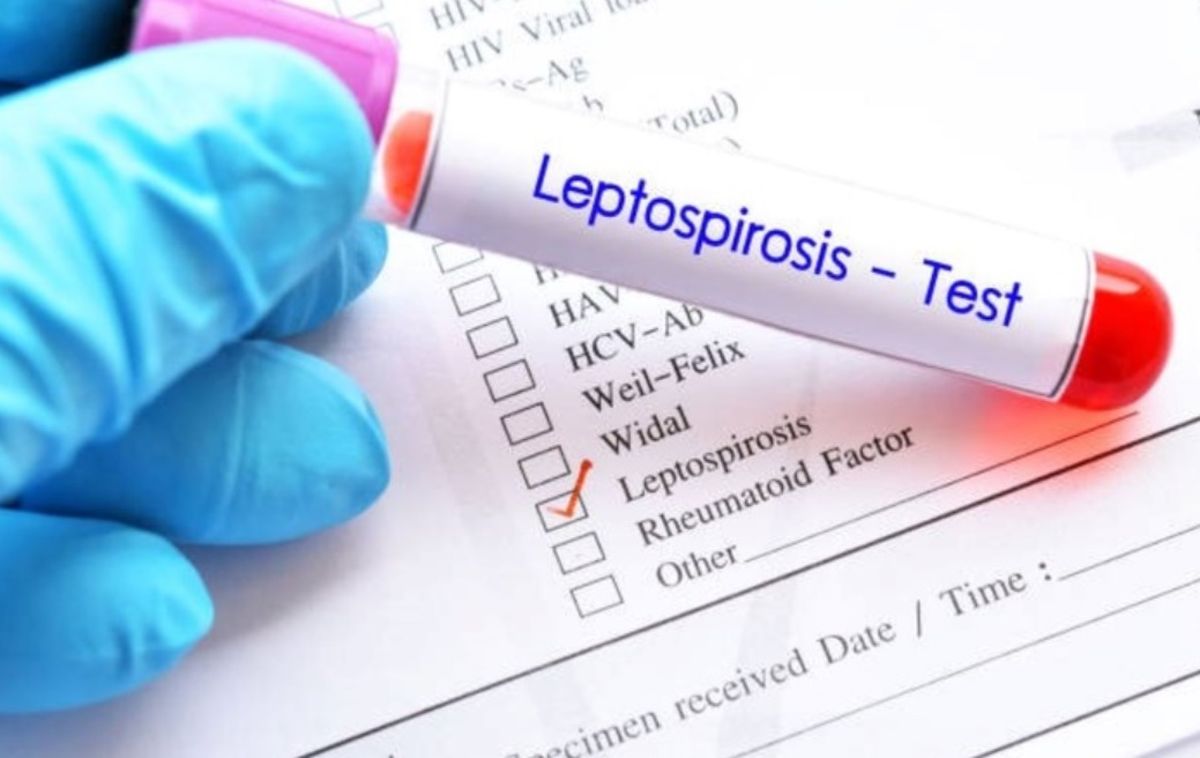 Las autoridades han mostrado preocupación por el incremento de casos de leptospirosis y hay tres provincias en situación de alerta Las autoridades han mostrado preocupación por el incremento de casos de leptospirosis y hay tres provincias en situación de alerta