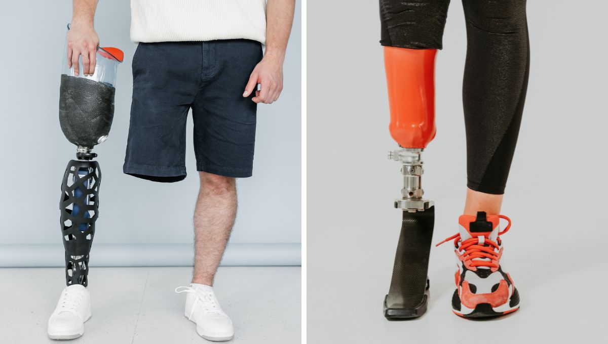 Las prótesis y órtesis deben ser cubiertas en un 100% por las obras sociales y prepagas. Las prótesis y órtesis deben ser cubiertas en un 100% por las obras sociales y prepagas. 