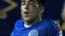 El sangriento codazo de un ex Tomba a Leandro Fernández