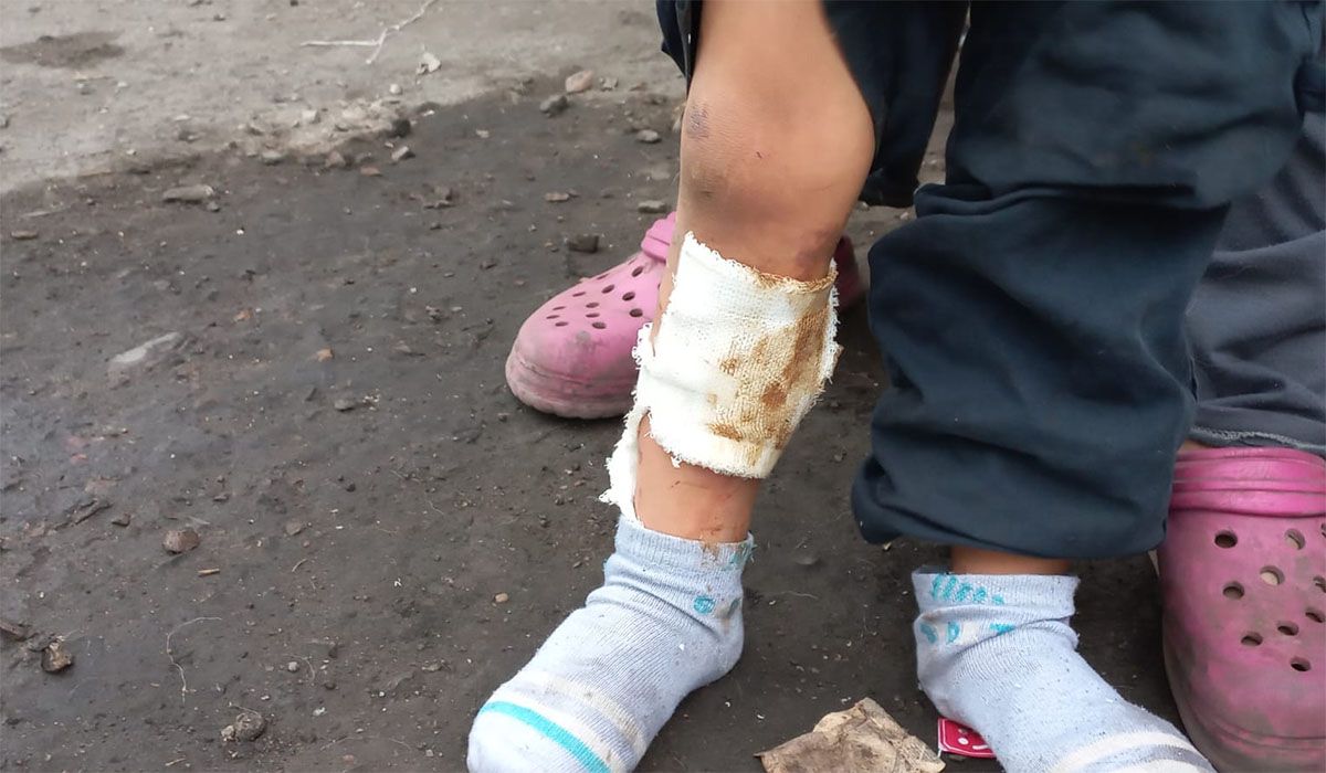 Un niño de dos años cayó en una grieta provocada por incendios subterráneos y sufrió quemaduras. Foto: Matías Pascualetti.