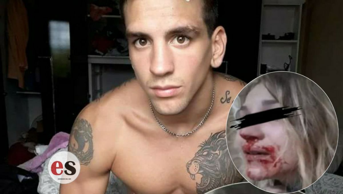 Detuvieron a un boxeador que desfiguró a su pareja embarazada