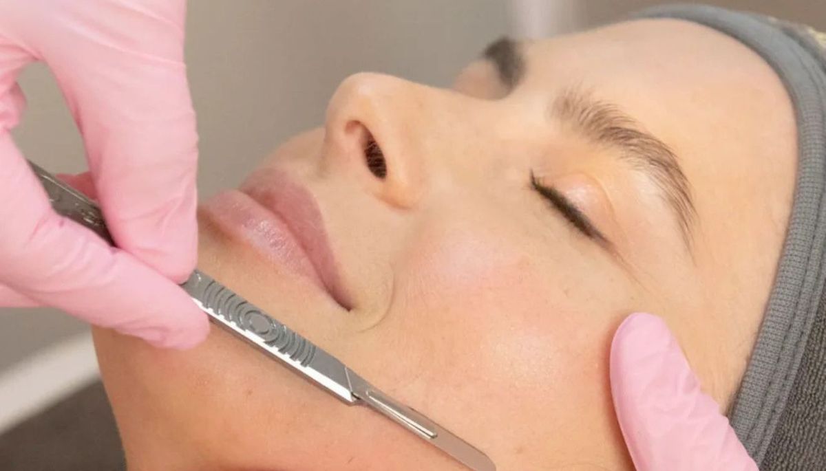 Para hacer dermaplaning se usa, básicamente, una cuchilla especial diseñada para la cara. Para hacer dermaplaning se usa, básicamente, una cuchilla especial diseñada para la cara.