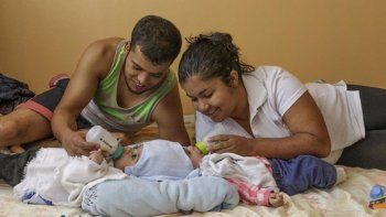 Médicos logran separar a siameses unidos por la cabeza